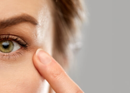 Photo of a woman pointing at the skin around her eye