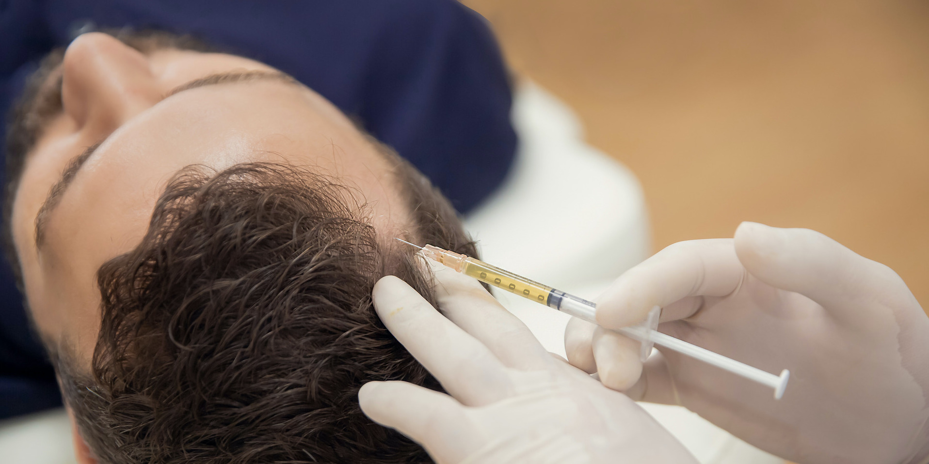 Hair Regrowth Injections