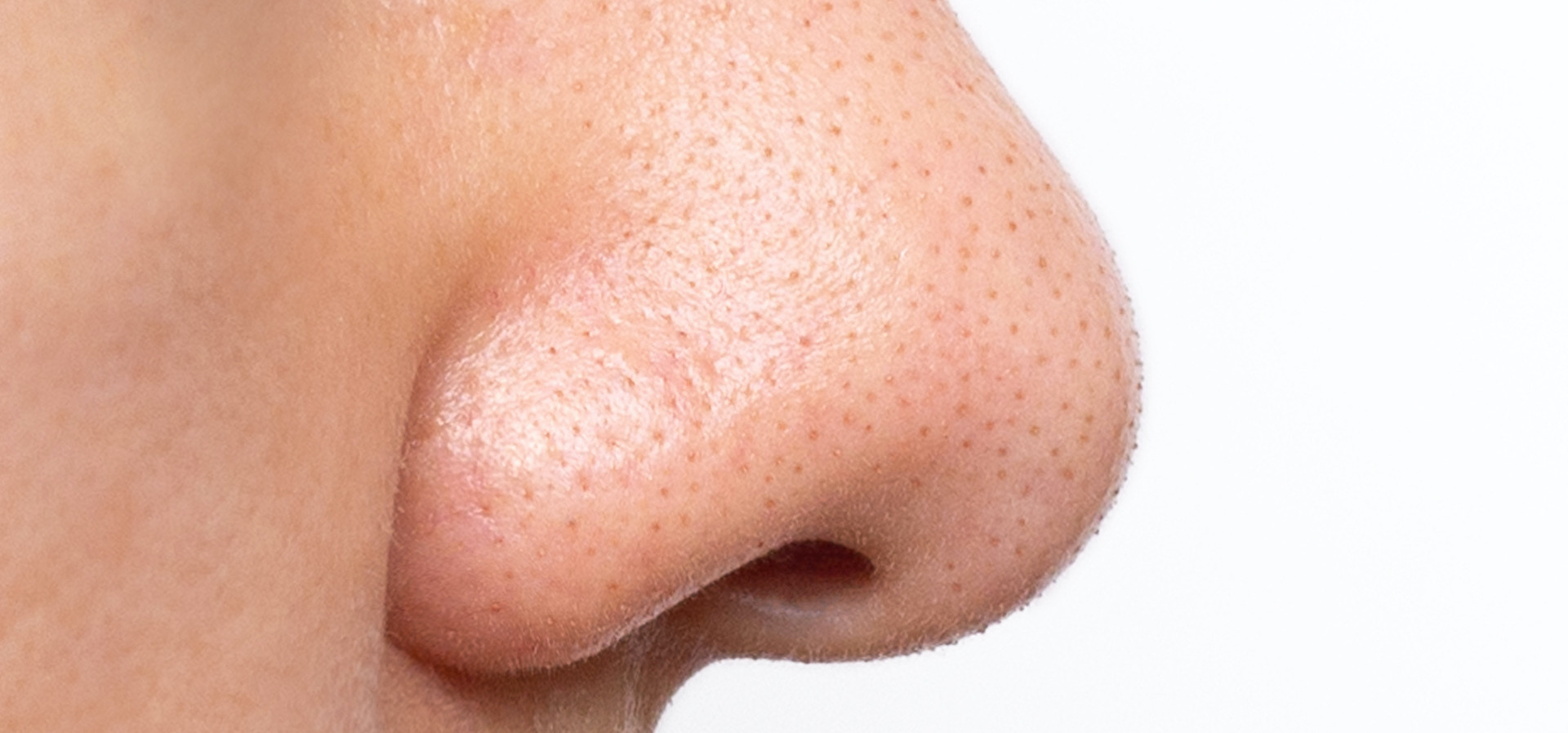 Large Pores