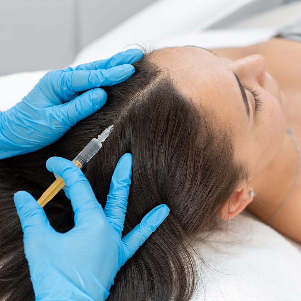 Photo of a woman receiving hair regrowth injections in her scalp