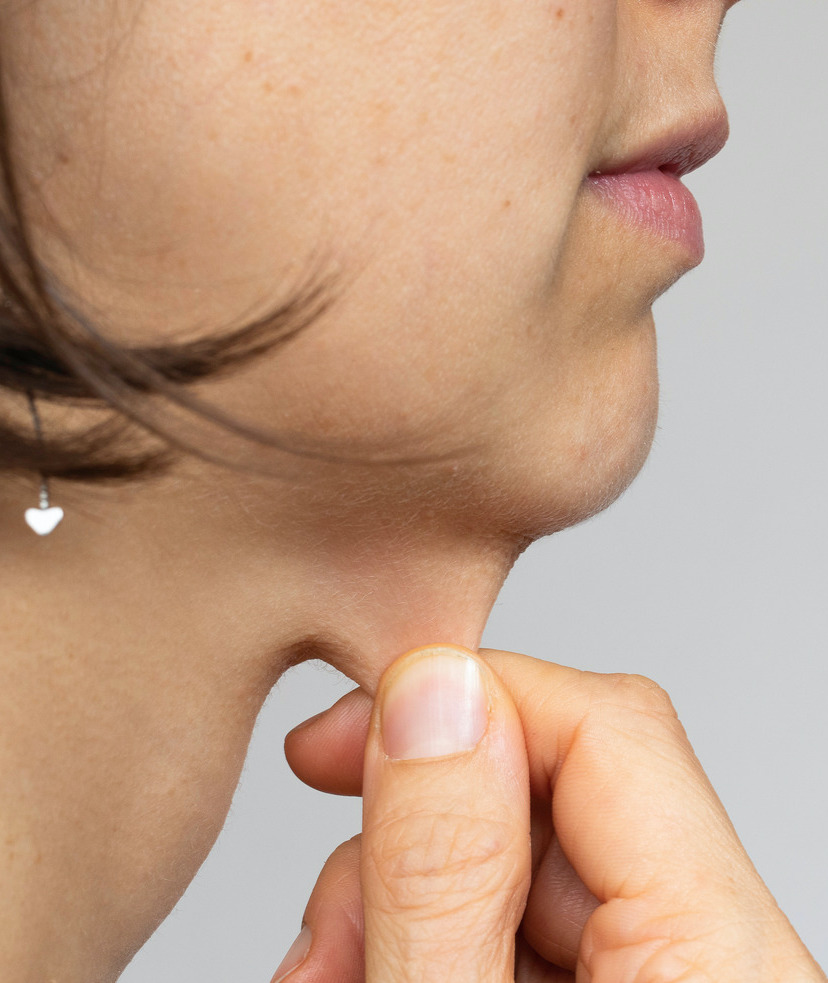 Photo of woman with loose skin on her neck